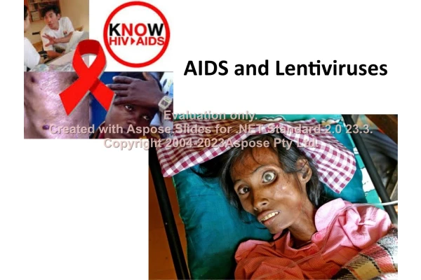 پاورپوینت AIDS and Lentiviruses      تعداد اسلاید : 159      نسخه کامل✅