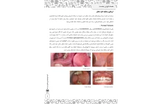 جزوه ارزیابی و معاینه حفره دهان