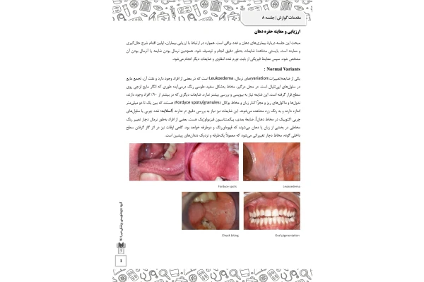 جزوه ارزیابی و معاینه حفره دهان