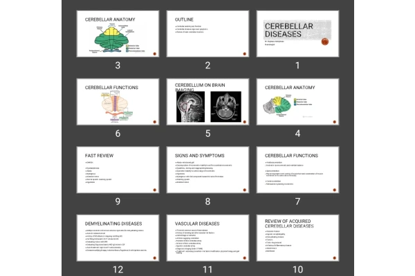 پاورپوینت بیماری های مخچه Cerebellar diseases