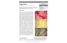 آميلوئيدوز(2) 🔬 نسخه کامل ✅