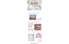 اصطلاحات،مواد و وسایل در بخش ترمیم دندانپزشکی