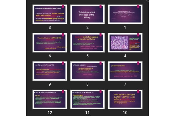 پاورپوینت Tubulointerstitial Diseases of the Kidney