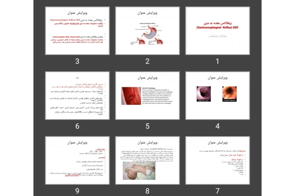 پاورپوینت ریفلاکس معده به مری