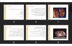 پاورپوینت گلومرولونفریت