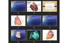 پاورپوینت سکته قلبی (آنفارکتوس میوکارد)