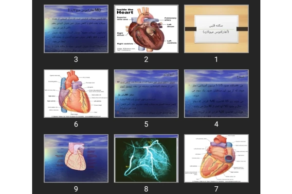 پاورپوینت سکته قلبی (آنفارکتوس میوکارد)
