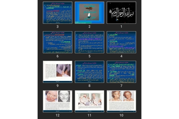 پاورپوینت معاينه سيستم حركتی