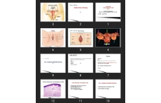 پاورپوینت PATHOLOGY FEMALE GENITAL SYSTEM Part ۱