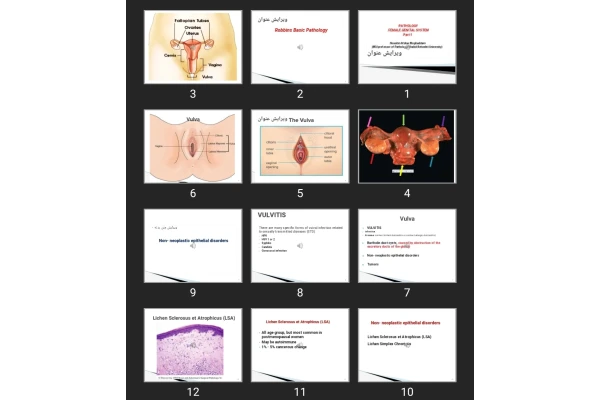 پاورپوینت PATHOLOGY FEMALE GENITAL SYSTEM Part ۱