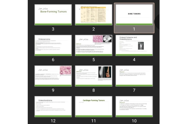 پاورپوینت BONE TUMORS