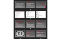 پاورپوینت vasculitis وسکولیت