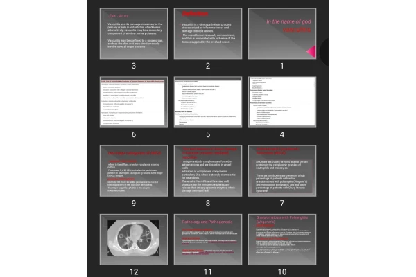 پاورپوینت vasculitis وسکولیت