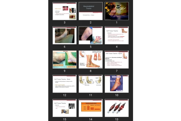 پاورپوینت Musculoskeletal trauma