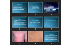 پاورپوینت Scarlet Fever