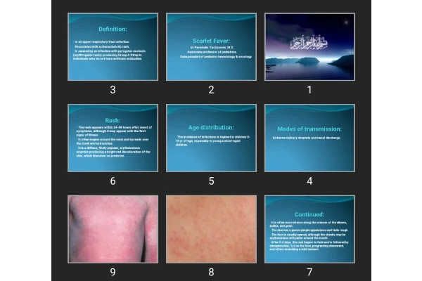 پاورپوینت Scarlet Fever