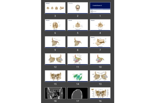 پاورپوینت Cranial Bones II