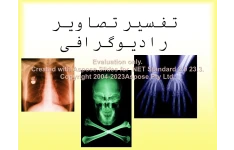 پاورپوینت تفسیر تصاویر رادیوگرافی      تعداد اسلاید : 214      نسخه کامل✅