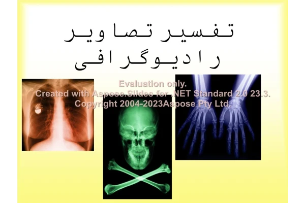 پاورپوینت تفسیر تصاویر رادیوگرافی      تعداد اسلاید : 214      نسخه کامل✅