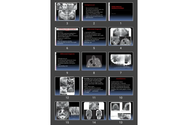 پاورپوینت Pericoronal Radiolucensies