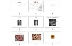 پاورپوینت Toxocariasis vlm