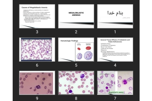 پاورپوینت MEGALOBLASTIC ANEMIAS