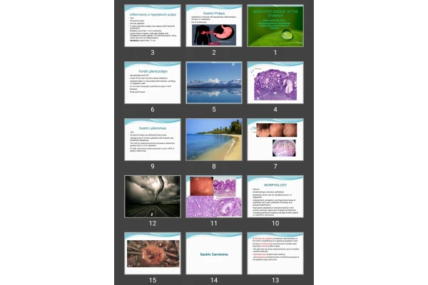 پاورپوینت NEOPLASTIC DISEASE OF THE STOMACH