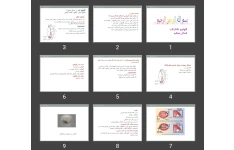 پاورپوینت گلوکوم، کاتاراکت و کندگی شبکیه