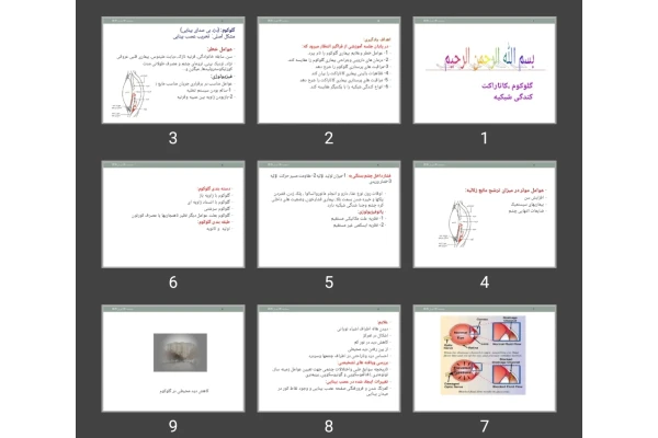 پاورپوینت گلوکوم، کاتاراکت و کندگی شبکیه
