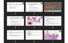 پاورپوینت Skin Pathology , part 2 (other skin diseases)