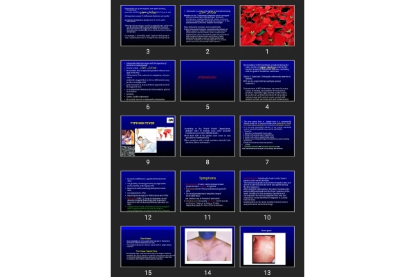 پاورپوینت Salmonella - shigella