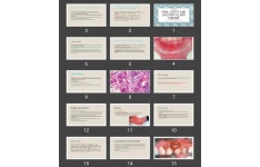 پاورپوینت Oral cavity and salivary gland disease