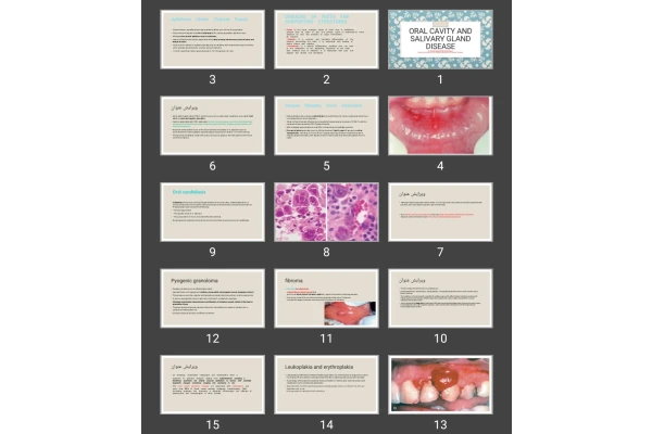 پاورپوینت Oral cavity and salivary gland disease