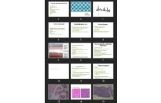 پاورپوینت Female genital pathology