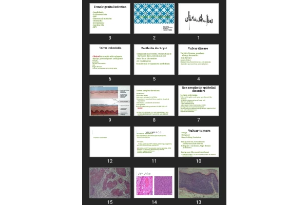 پاورپوینت Female genital pathology