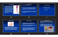 پاورپوینت Gastric cancer