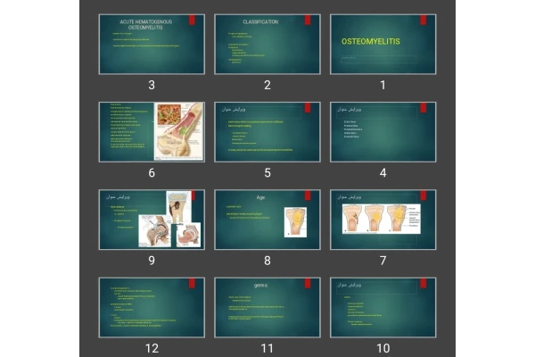 پاورپوینت استئومیلیت OSTEOMYELITIS