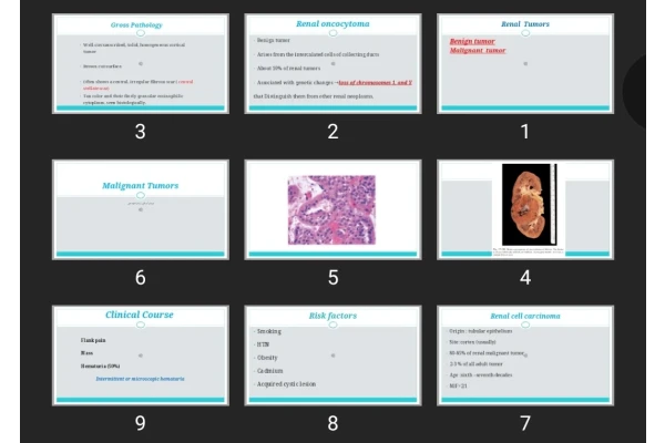 پاورپوینت Renal Tumors