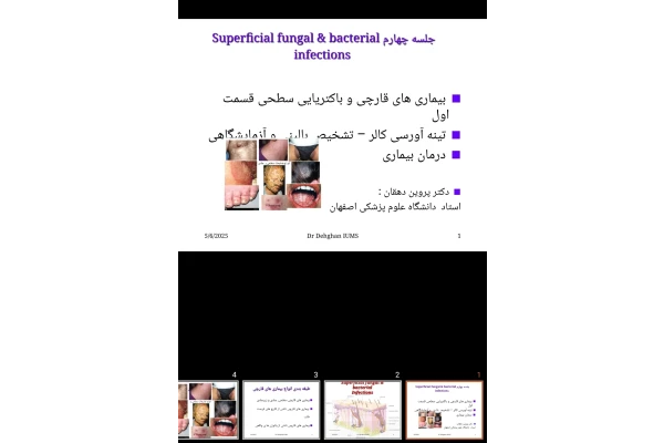 پاورپوینت بیماری های قارچی سطحی، تینه آ ورسی کالر، تریکوباکتریوزیس آگزیلارس، اریتراسما