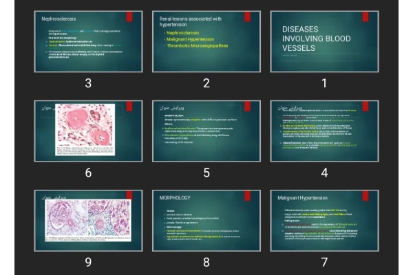 پاورپوینت DISEASES INVOLVING BLOOD VESSELS
