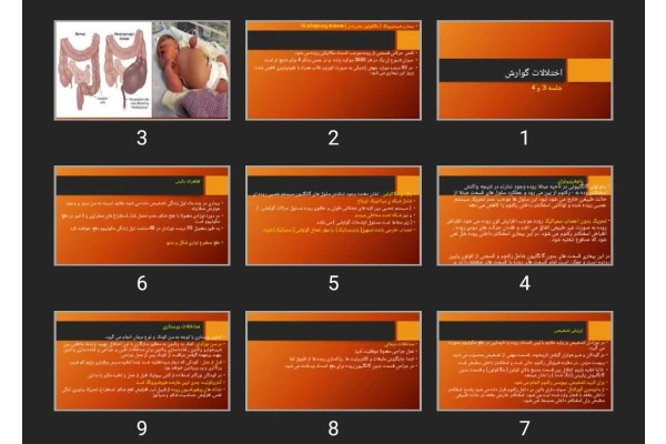 پاورپوینت اختلالات گوارش