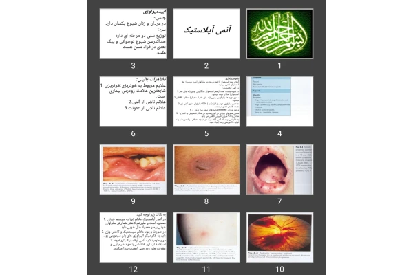 پاورپوینت آنمی آپلاستیک