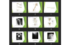 پاورپوینت Skeletal System