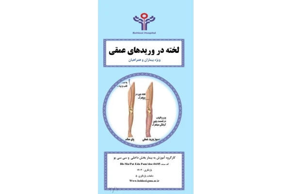 پمفلت لخته در وریدهای عمقی