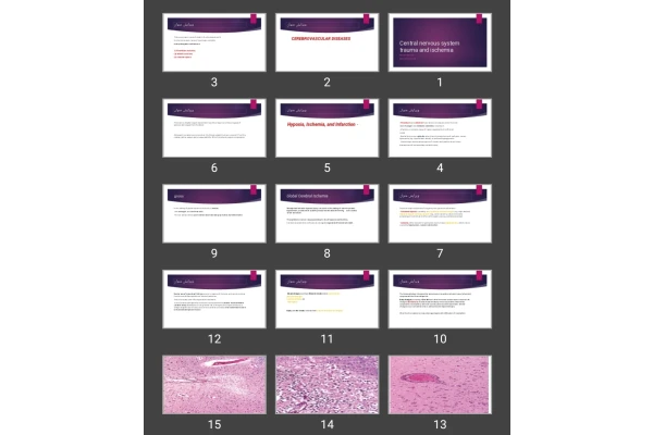 پاورپوینت Central nervous system trauma and ischemia