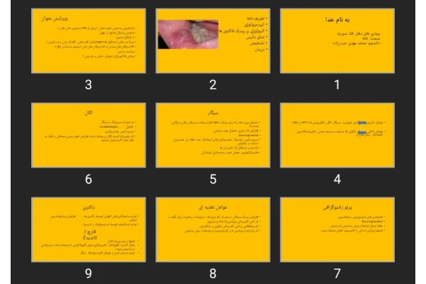 پاورپوینت بیماری های دهان فک صورت مبحث scc