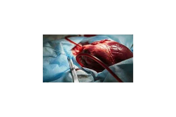   جزوه جراحی قلب