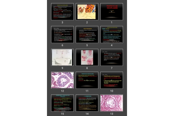 پاورپوینت Testicular neoplasms