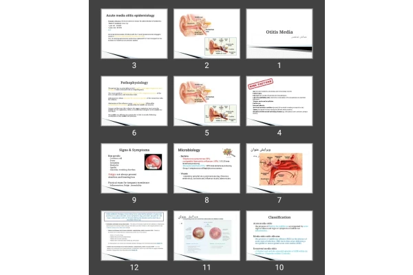 پاورپوینت Otitis Media