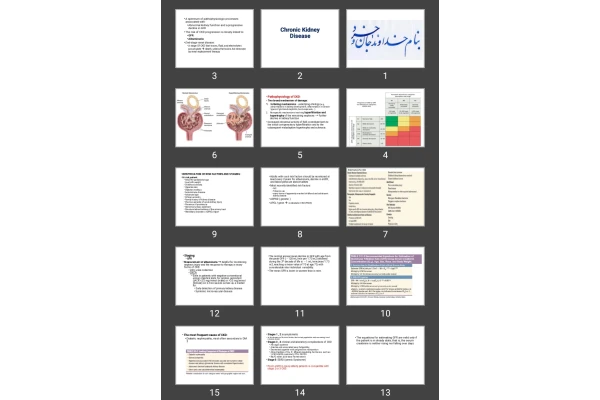 پاورپوینت Chronic Kidney Disease